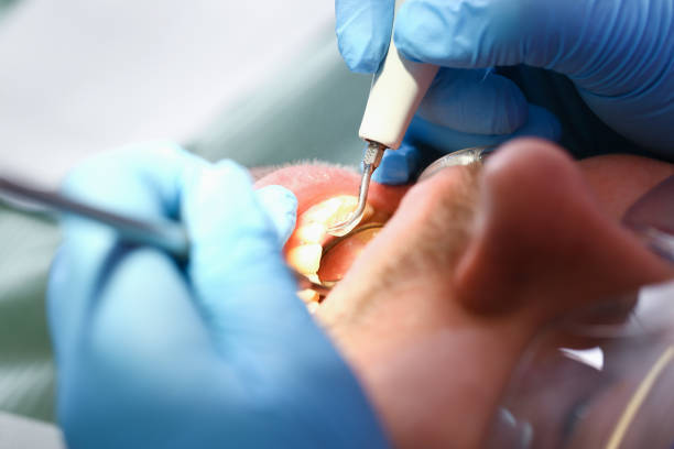 Best Mobile Emergency Dentist in East Cleveland, OH