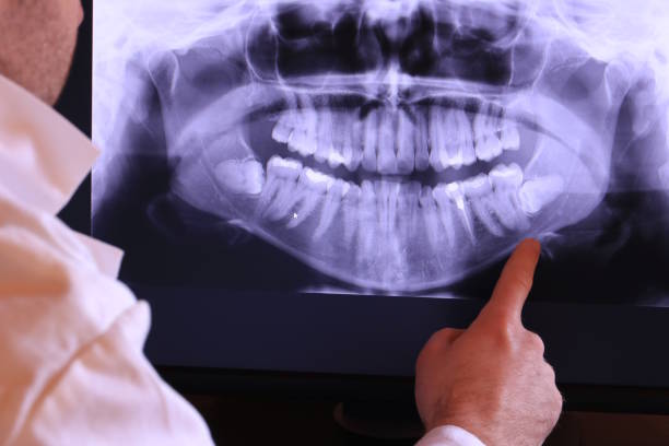 Best Mobile Emergency Dentist in East Cleveland, OH