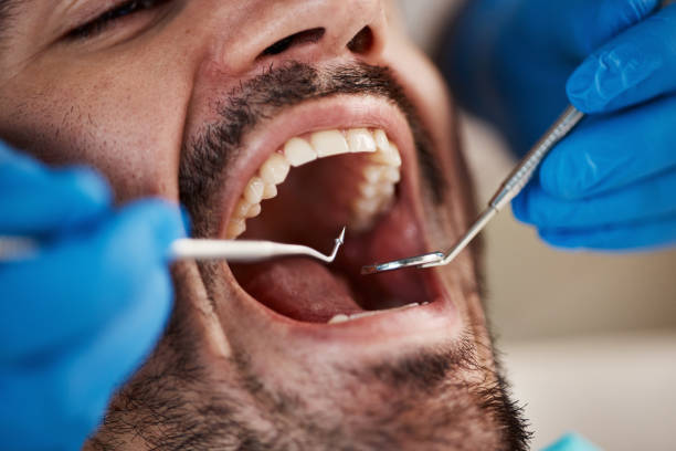 Best Weekend Emergency Dentist in East Cleveland, OH